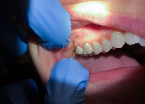 Best Emergency Gum Pain Relief  in Mesilla, NM